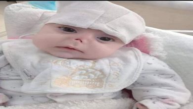 صورة الجرذان شوهت وجهها.. صورة طفلة حديثة الولادة تخلى عنها أهلها تهز حلب