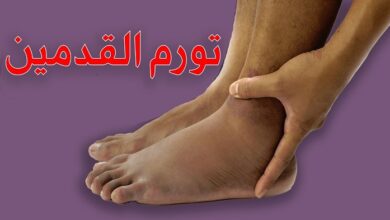 صورة احذر أشهر أسباب تورم القدمين المفاجئ وطريقة علاجه منزليا!!!